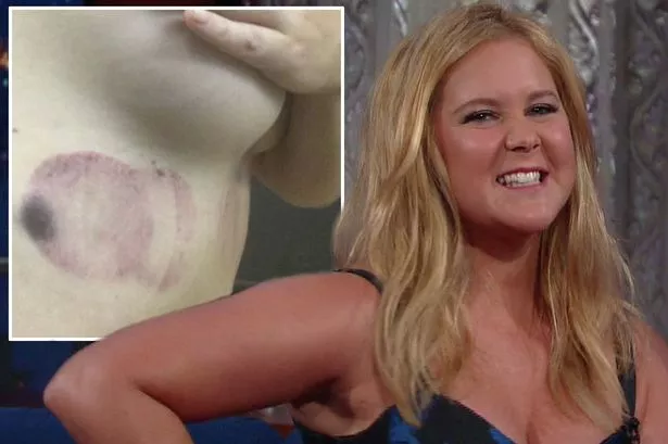 chey brown recommends amy schumer tit out pic
