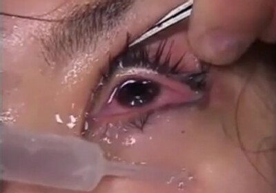 Best of Cum in eye