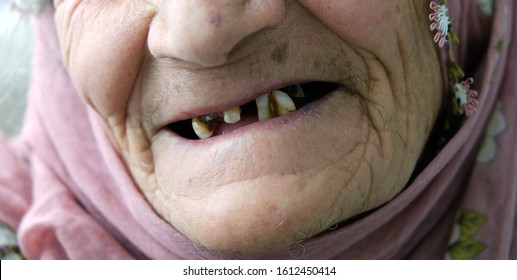 old woman without teeth