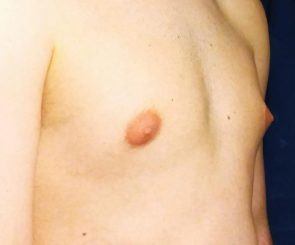 clive cox recommends flat chest puffy nipples pic