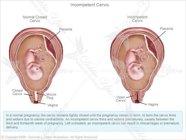 charlie gossett add photo hitting the cervix