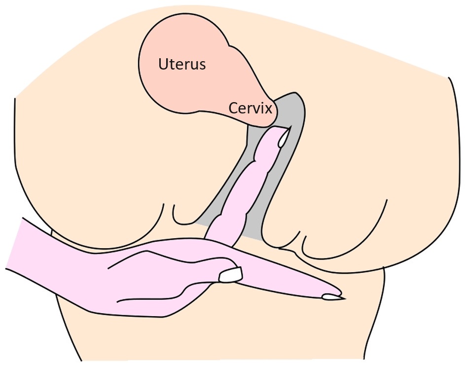 cindy shorey add positions to avoid hitting cervix photo