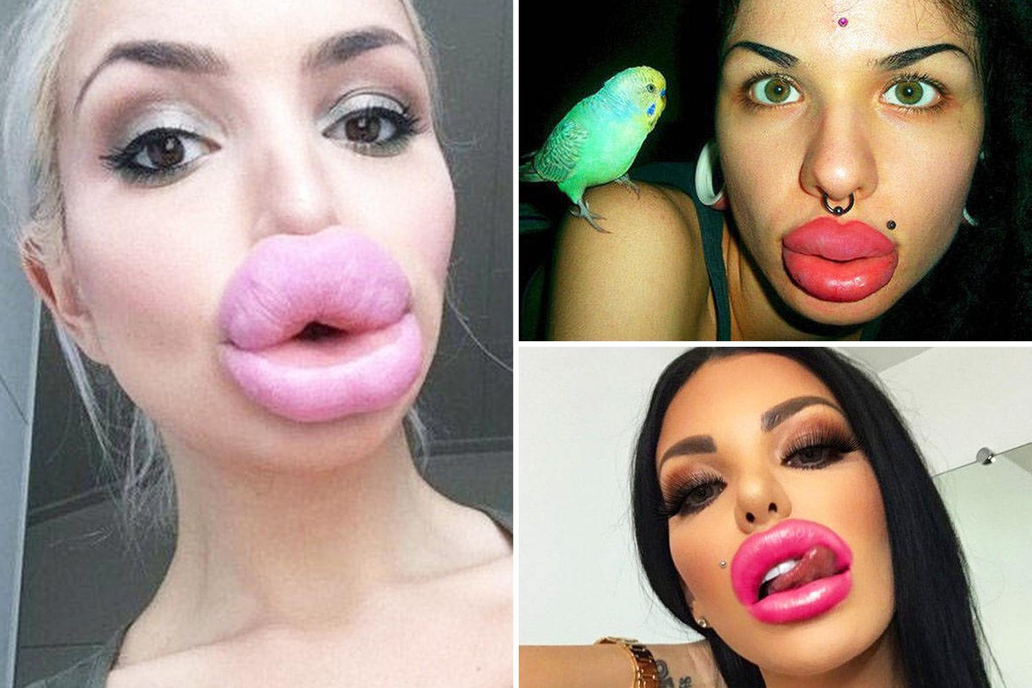 alexander duran recommends fake lips porn pic
