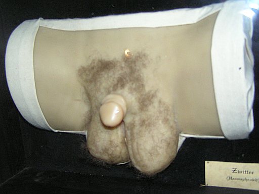 ainhoa salvador recommends pictures of hermaphrodite genitals pic