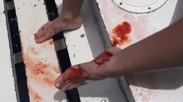 amella mankin share pornstar attacked by shark photos