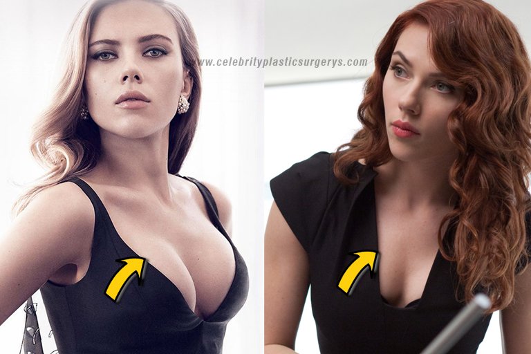 donna drain recommends Scarlett Johansson Fake Breasts
