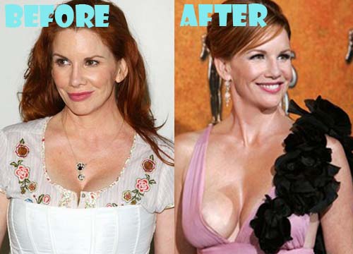 Best of Melissa gilbert tits