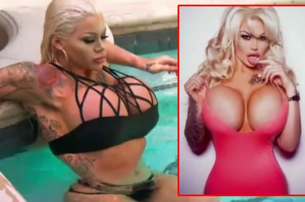 bridget spratt recommends big huge fake boobs pic