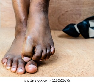 domagoj baric recommends Black Ebony Feet Pics