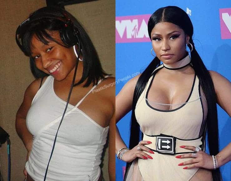 dilp kumar recommends are nicki minaj breasts real or fake pic