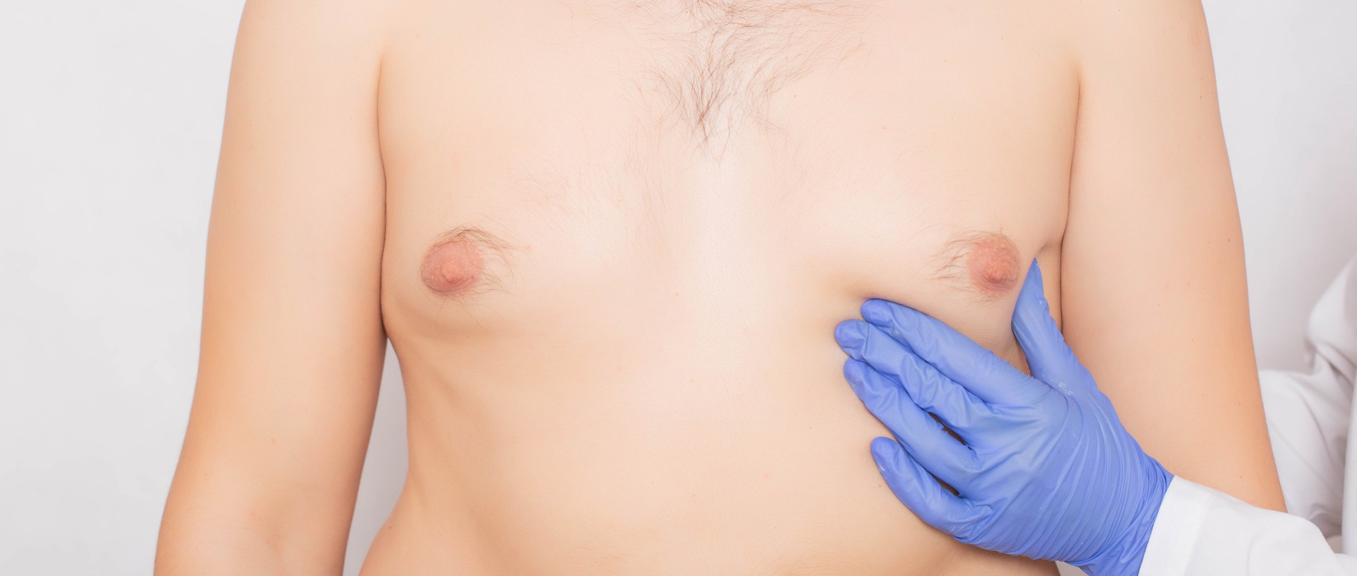avnish bajaj recommends flat chest puffy nipples pic
