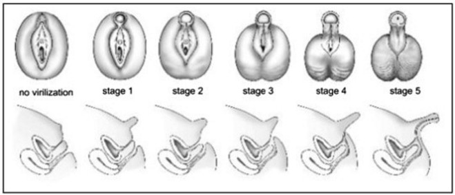 bill rymer recommends Intersex Photos Of Genitalia