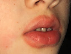 lips made for sucking