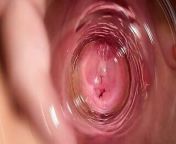 dewald fourie recommends Camera Inside Vagina Orgasm