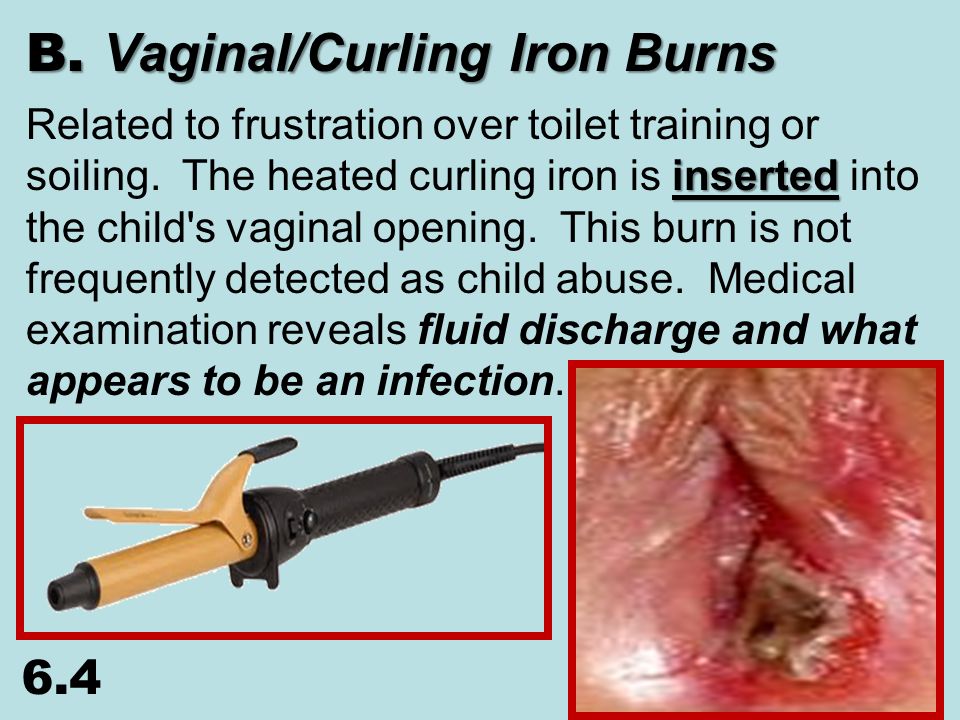 brian isam add photo curling iron in vagina