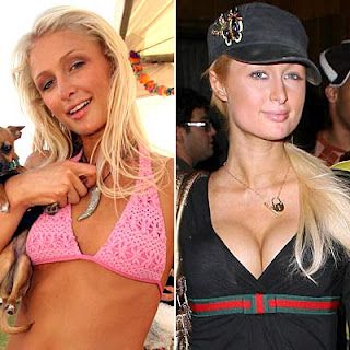 bunny barnes share paris hilton boobs photos