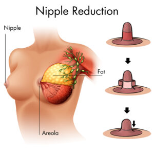for the love of areolas