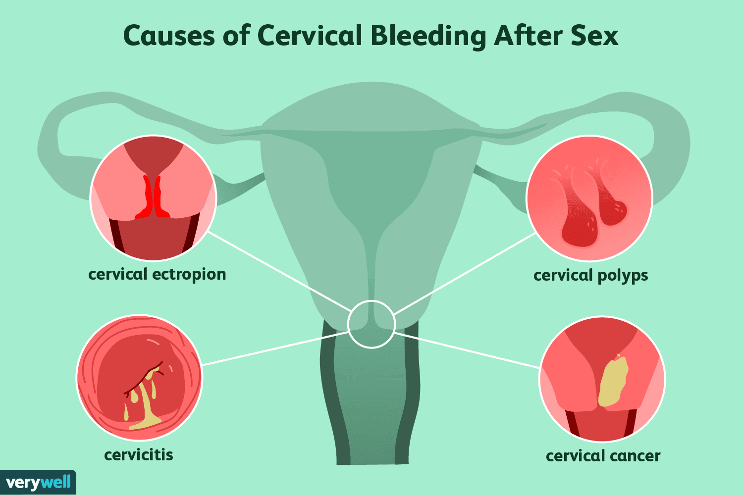 ashley vanderheyden recommends Hitting The Cervix