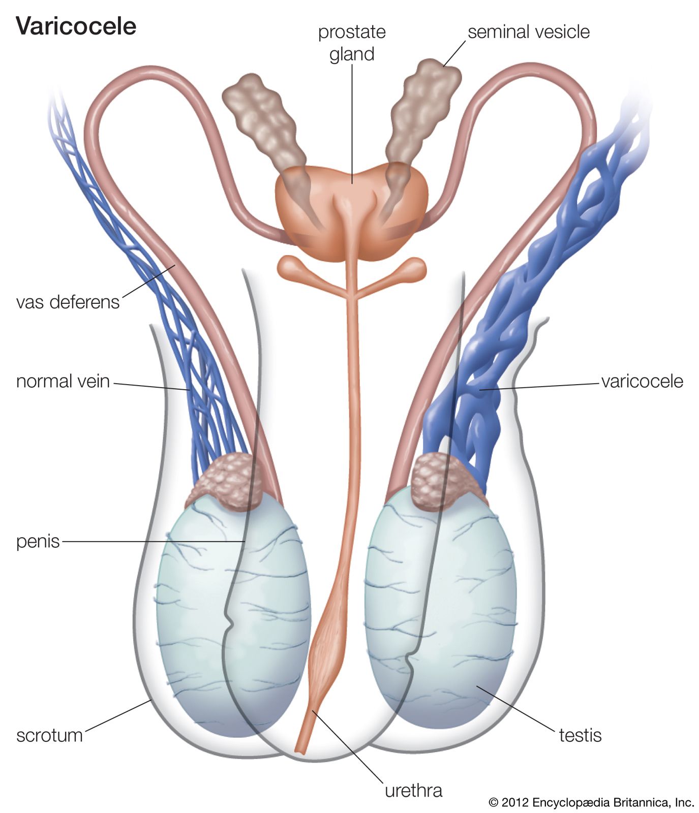 brionna miles add intersex photos of genitalia photo