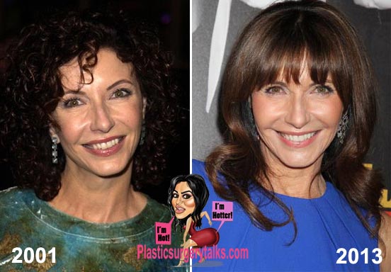 angela rivers add mary steenburgen boob job photo