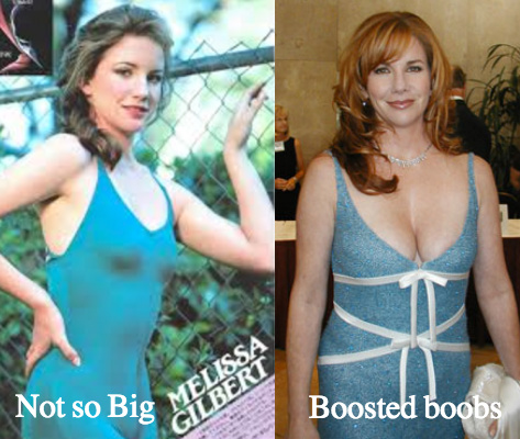 andy volz recommends melissa gilbert tits pic