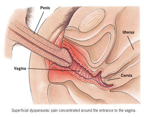 penis in vagina pic
