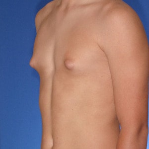 Puffy Nipple Photos topless teens