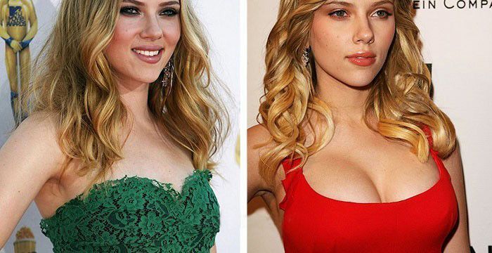 azhar md isa recommends Scarlett Johansson Fake Breasts