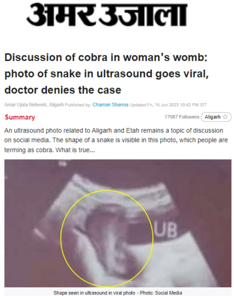 anna dominiak recommends snake in vagina video pic